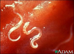 Hookworm - Ancyclostoma caninum Hookworm - Ancyclostoma caninum