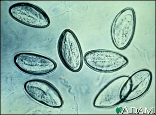 Pinworm eggs Pinworm eggs