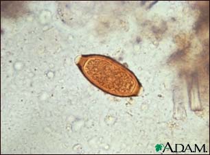 Trichuris trichiura egg Trichuris trichiura egg
