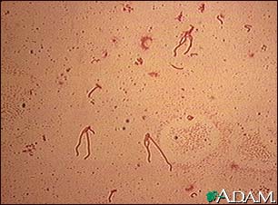 Yersinia enterocolitica organism Yersinia enterocolitica organism