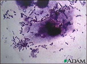 Pneumococci organism Pneumococci organism
