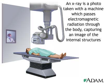 X-ray X-ray