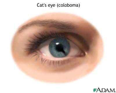 Cat eye Cat eye