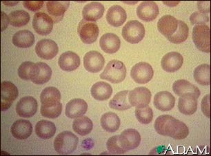 Malaria, microscopic view of cellular parasites Malaria, microscopic view of cellular parasites