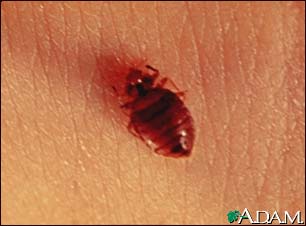 Bedbug - close-up Bedbug - close-up
