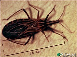 Kissing bug Kissing bug