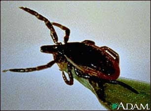 Tick, deer - adult female Tick, deer - adult female