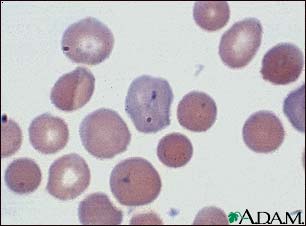 Malaria, microscopic view of cellular parasites Malaria, microscopic view of cellular parasites