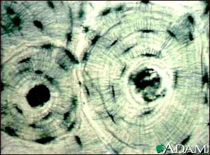 Bone Tissue Bone Tissue