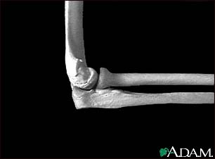 Elbow - side view Elbow - side view