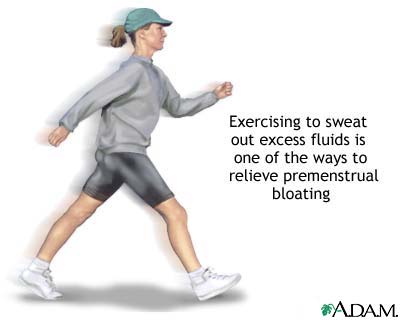 Premenstrual bloating Premenstrual bloating