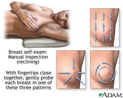 Breast self-exam Breast self-exam