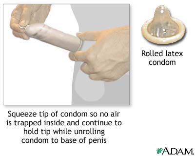 The male condom The male condom