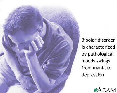 Bipolar disorder Bipolar disorder