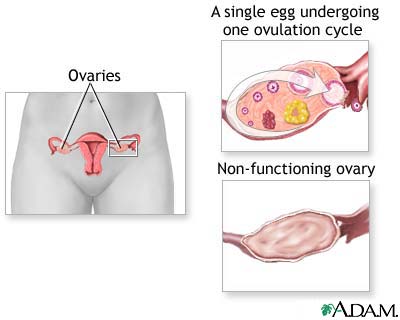 Ovarian hypofunction Ovarian hypofunction