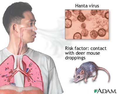 Hanta virus Hanta virus