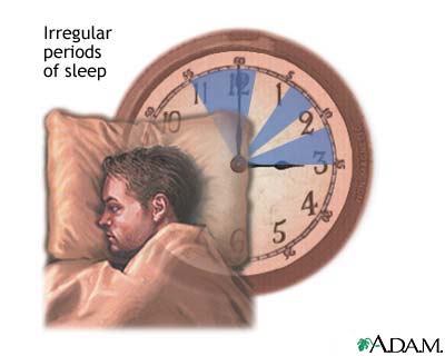 Irregular sleep Irregular sleep
