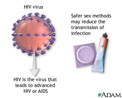 HIV HIV