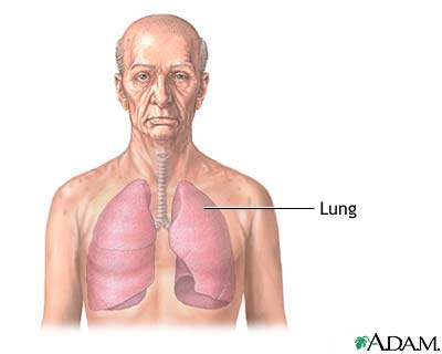 The lungs The lungs