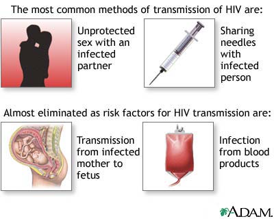 Primary HIV infection Primary HIV infection