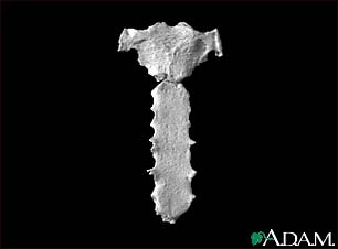 Sternum - view of the outside (anterior) Sternum - view of the outside (anterior)