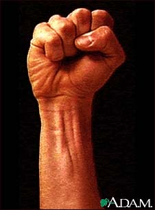 Surface anatomy - normal wrist Surface anatomy - normal wrist