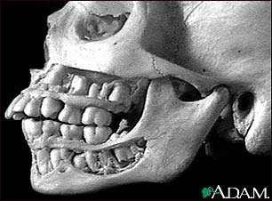 Teeth, adult - in the skull Teeth, adult - in the skull