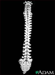 Vertebral column Vertebral column