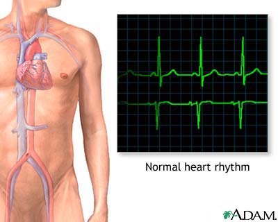 Normal heart rhythm Normal heart rhythm