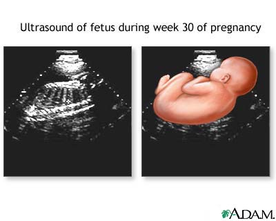 30 week ultrasound 30 week ultrasound