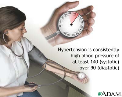 Monitoring blood pressure Monitoring blood pressure