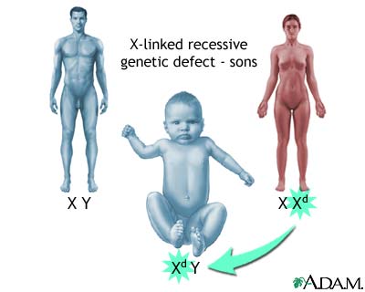 X-linked recessive genetic defects - how boys are affected X-linked recessive genetic defects - how boys are affected