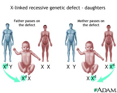 X-linked recessive genetic defects - how girls are affected X-linked recessive genetic defects - how girls are affected