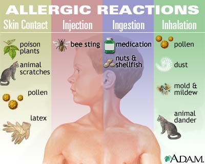 Allergic reactions Allergic reactions