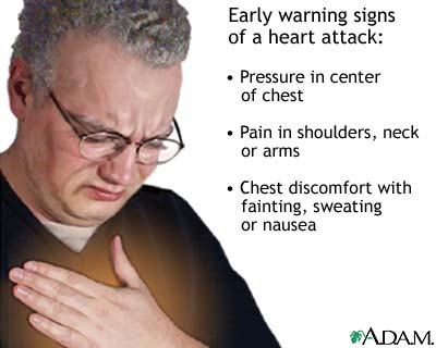 Heart attack symptoms Heart attack symptoms