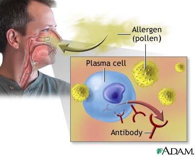 Recognizing invader Recognizing invader