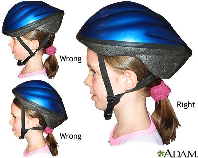 Bicycle helmet - proper usage Bicycle helmet - proper usage