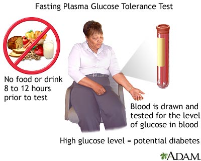Fasting glucose tolerance test Fasting glucose tolerance test