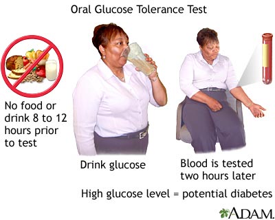 Oral glucose tolerance test Oral glucose tolerance test