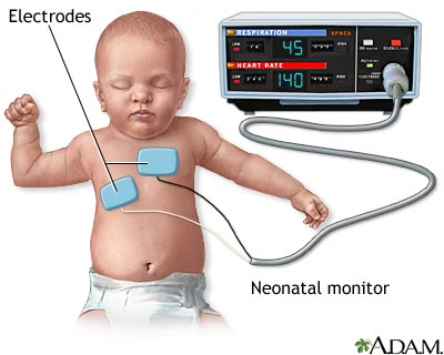 Heart - respiratory monitor Heart - respiratory monitor