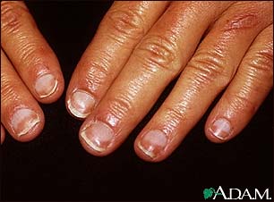 Half and half nails Half and half nails