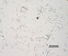 Struvite crystals dog with scale 1.JPG